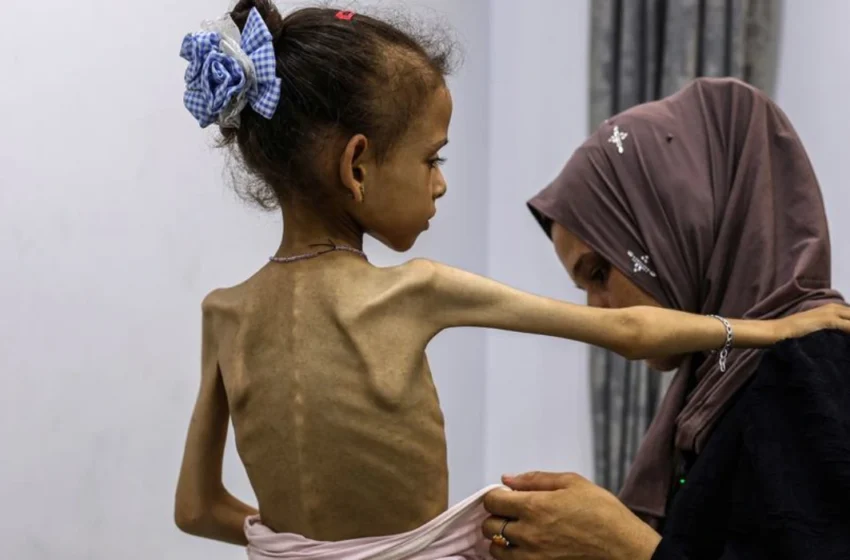  How UN Reports Expose Women and Children’s Plight Amid Gaza Famine?